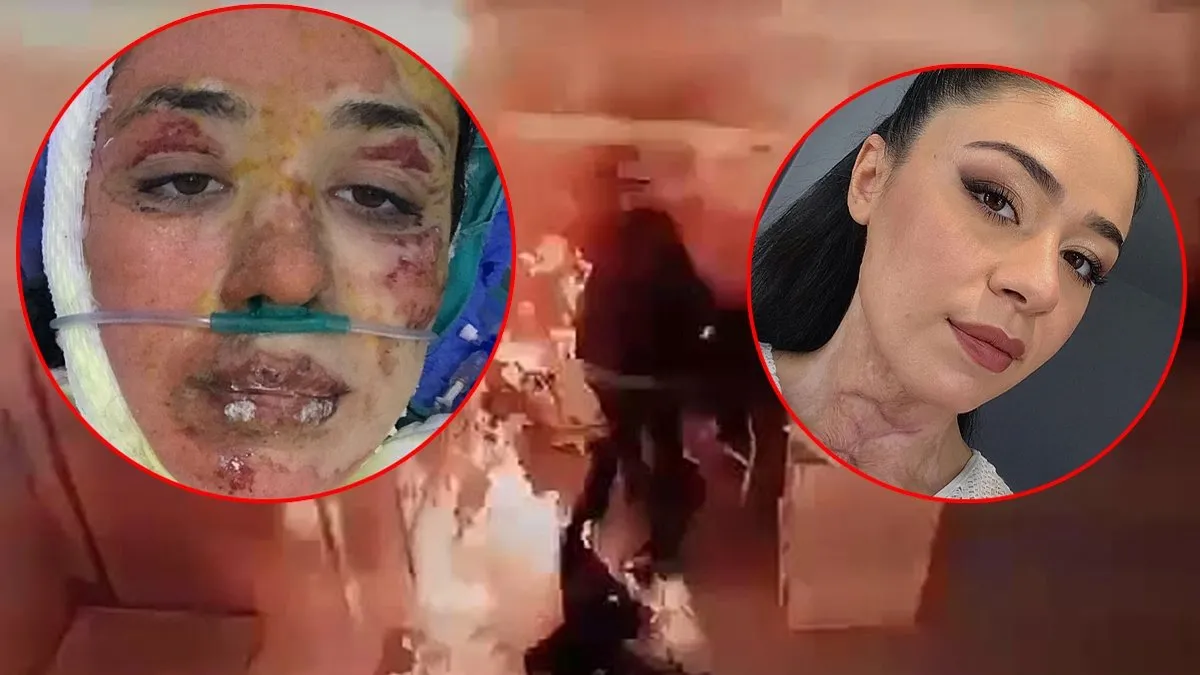 Gizem Hemşire hastanedeki dehşeti anlattı: “Yakayım mı sizi” dedi ve…